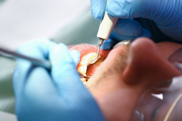 Best Pediatric Emergency Dentist in Buffalo Grove, IL